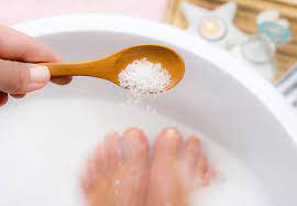 Home Remedies for Athlete's Foot: Natural Solutions for Itchy Feet